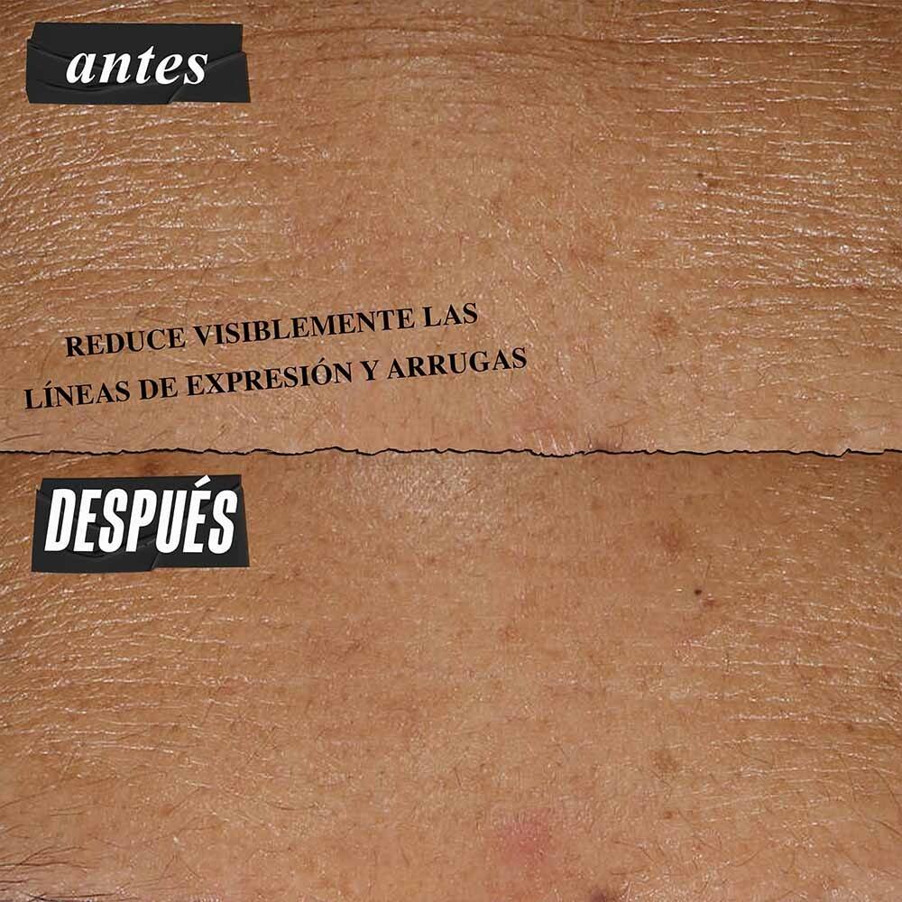 RETINOL SKIN-RENEWING DAILY MICRO-DOSE SERUM REAFIRMANTE ANTI SIGNOS DE LA EDAD (SUERO FACIAL)